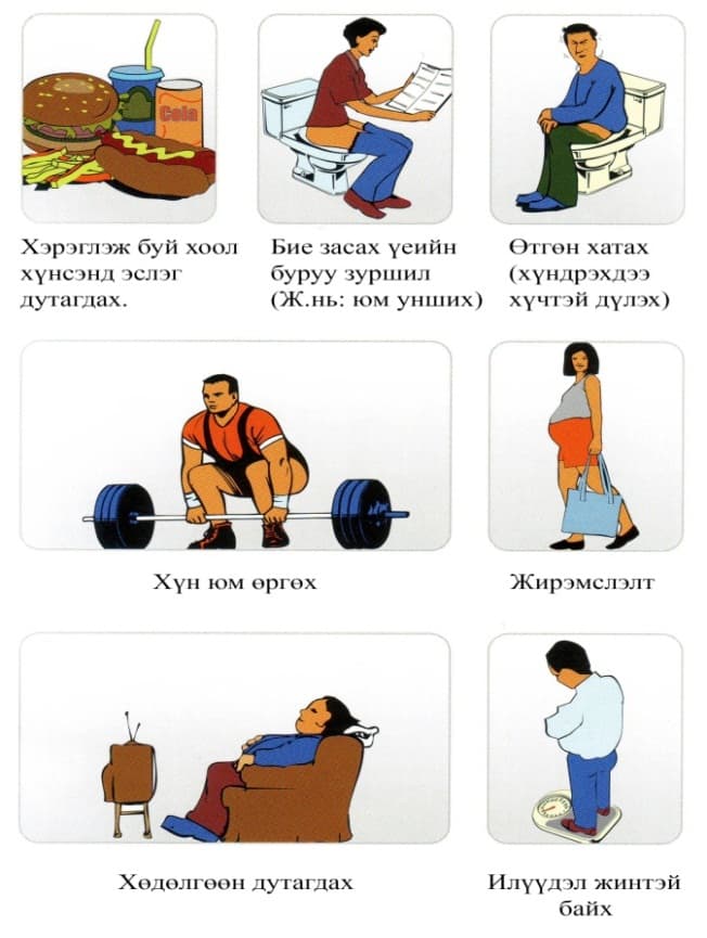 Шамбарам үүсэхэд нөлөөлдөг хүчин зүйлсийн зураглал
